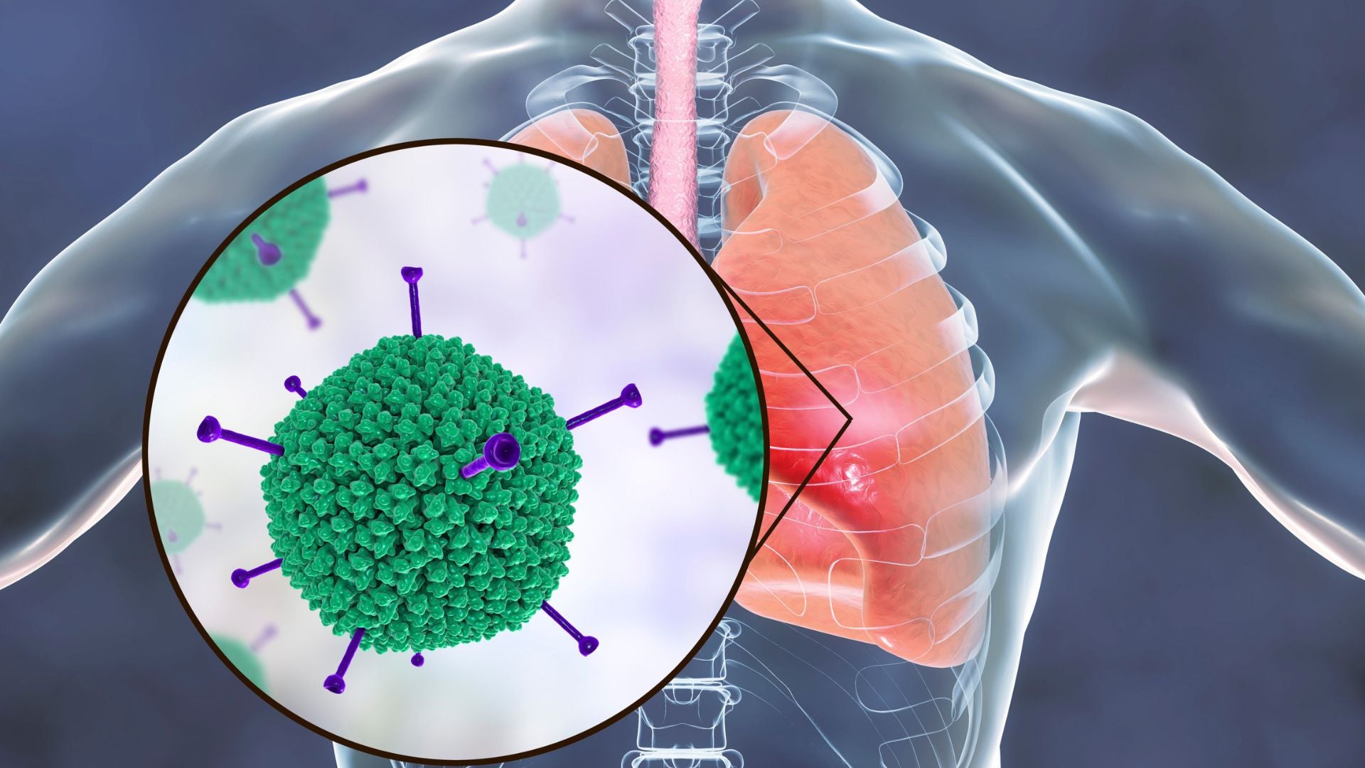 Understanding Respiratory Conditions